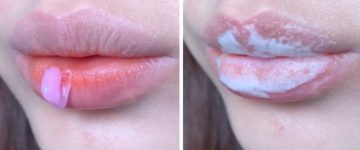 Tẩy Tế Bào Chết Môi: Bí Quyết Cho Đôi Môi Mềm Mịn, Căng Mọng