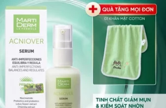 Top 5 Kem Trị Mụn Đầu Đen “Thần Thánh”: Đánh Bay Lì Lợm, Lấy Lại Làn Da Láng Mịn, Đều Màu Chuẩn Sao!